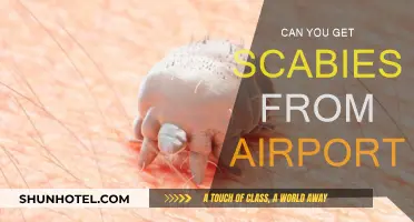 How Scabies Can Be Contracted at Airports