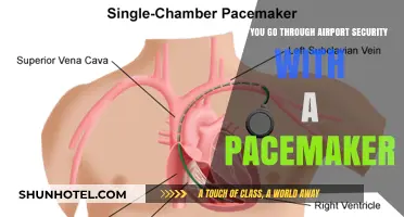 Airport Security and Pacemakers: What You Need to Know