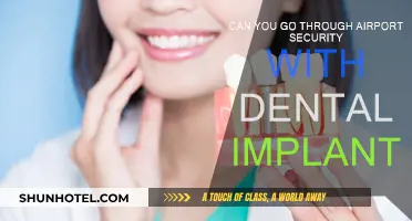 Dental Implants: Airport Security Clearance?