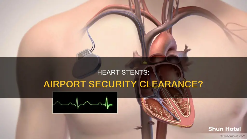 can you go through airport security with heart stents