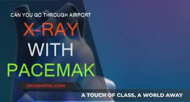 Airport X-Rays: Safe for Pacemaker Patients?