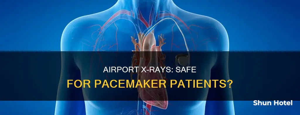can you go through airport x-ray with pacemaker