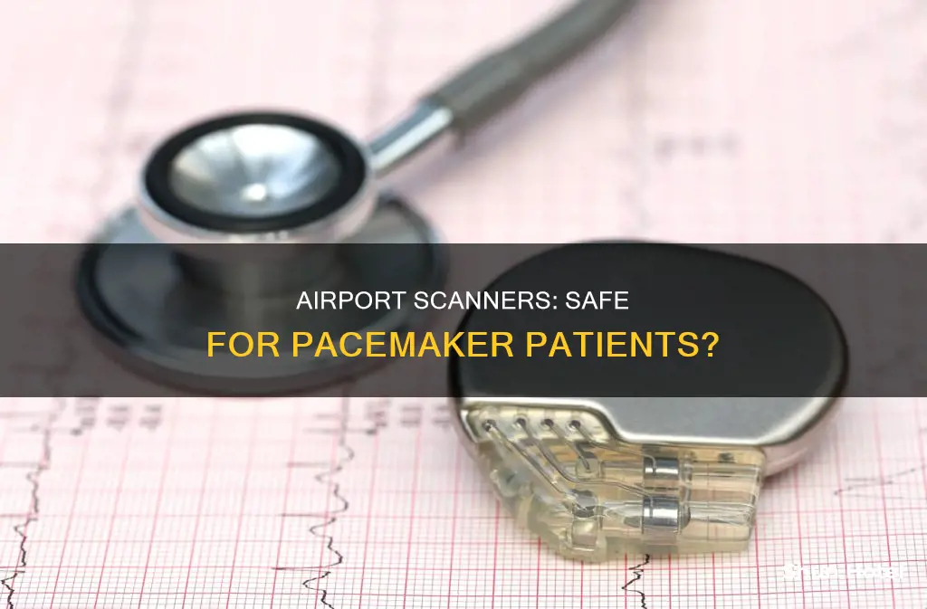 can you go through an airport scanner with a pacemaker