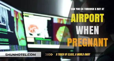 Pregnant and Traveling? X-ray Safety at Airports