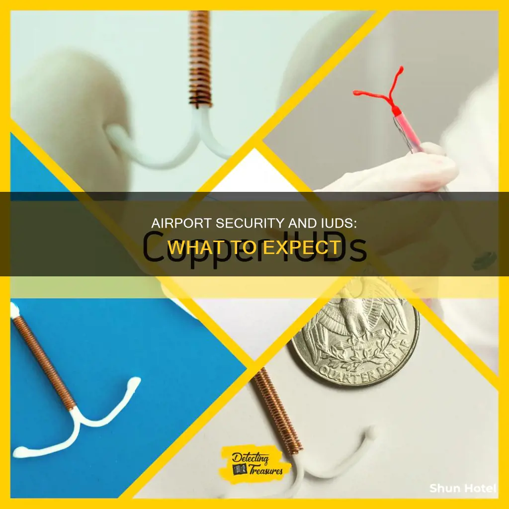 can you see an iud during airport security