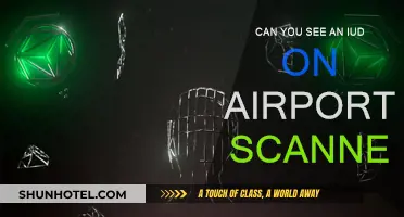 Airport Scanners and IUDs: What You Need to Know