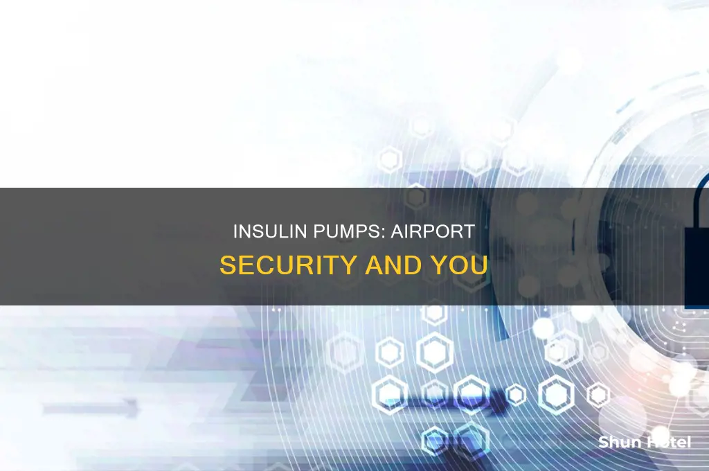 can you wear an insulin pump through airport security