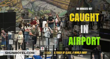 Do Braces Trigger Airport Security Alarms? What Travelers Need to Know