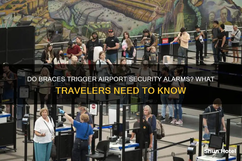 do braces get caught in airport