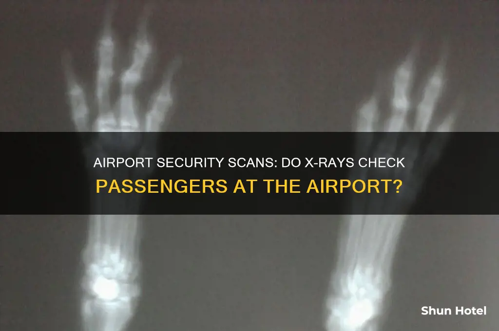 do you get x rayed at the airport