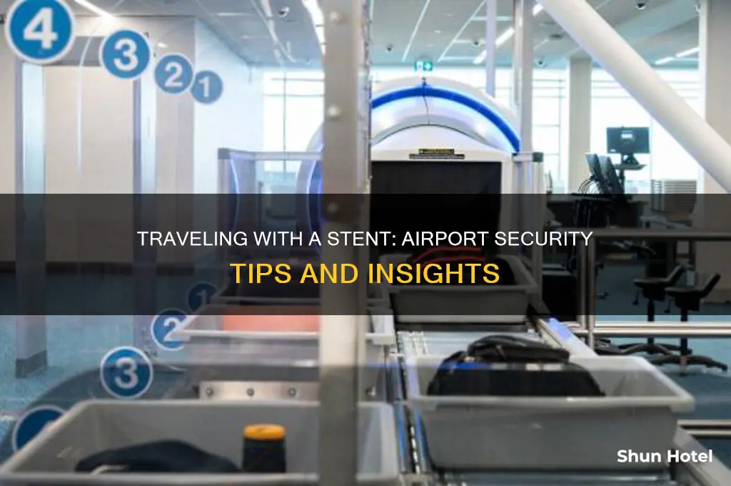 does a stent keep you from getting through airport security