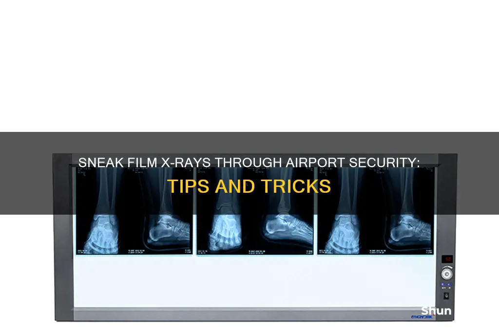 how to get film x-ray airport