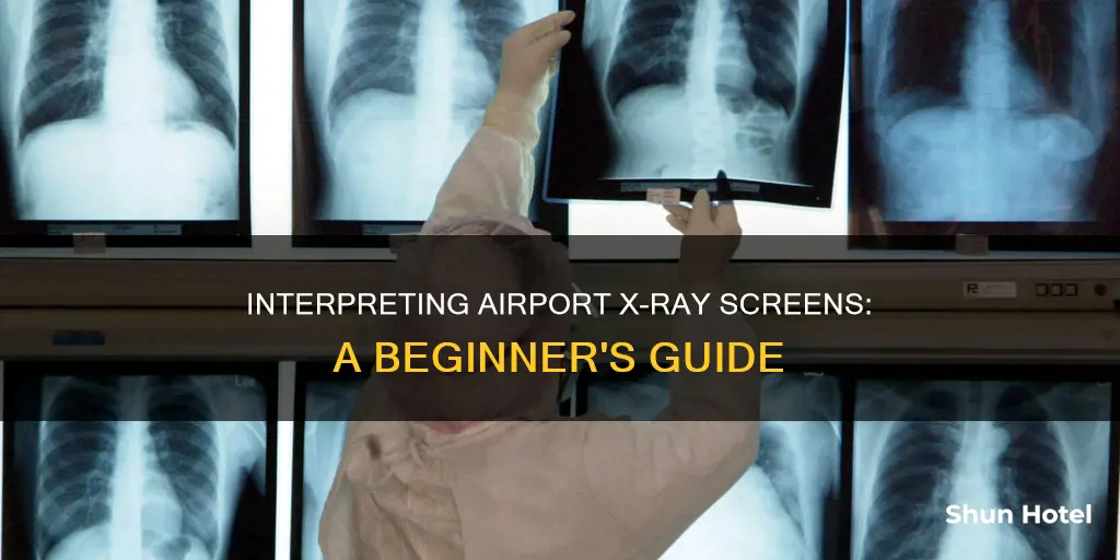 how to read airport xray screens