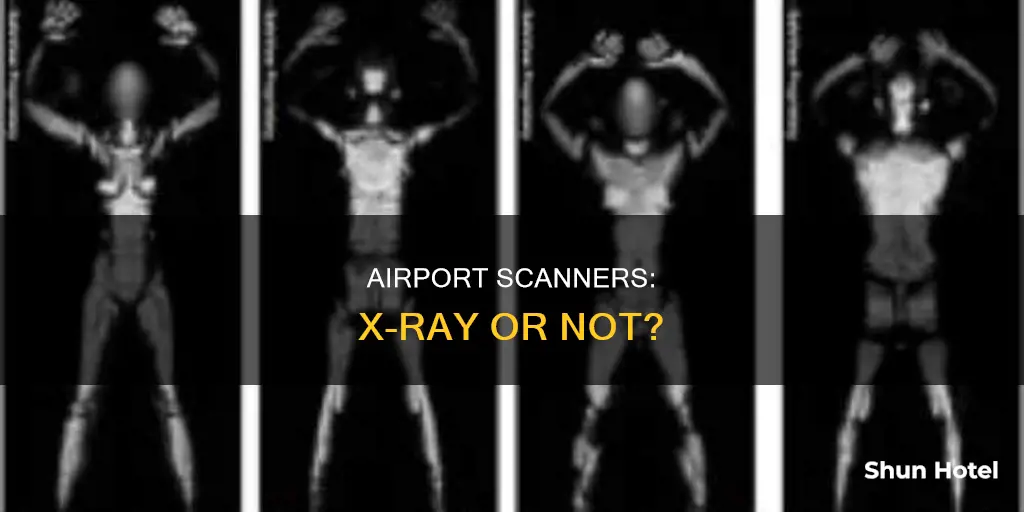 is the airport scanner an xray