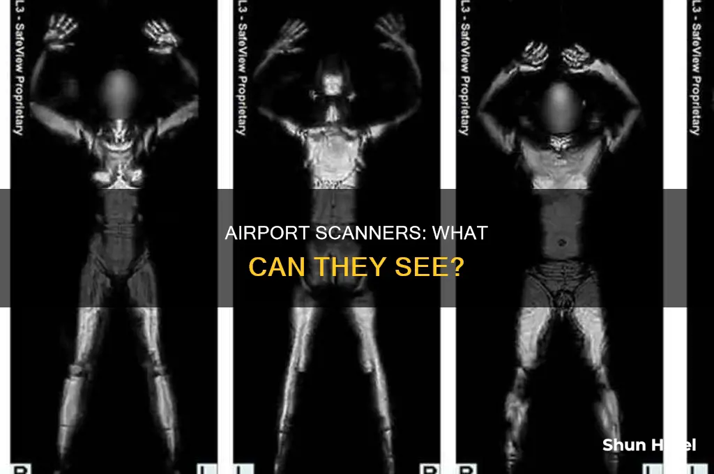 what can airport scanners see trackid sp-006
