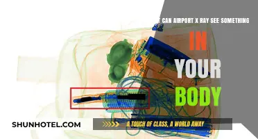 Airport X-Rays: Can They See Inside Your Body?