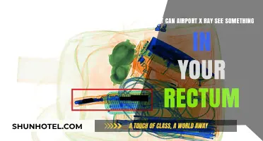 Can Airport X-Rays Detect Objects in Your Rectum?