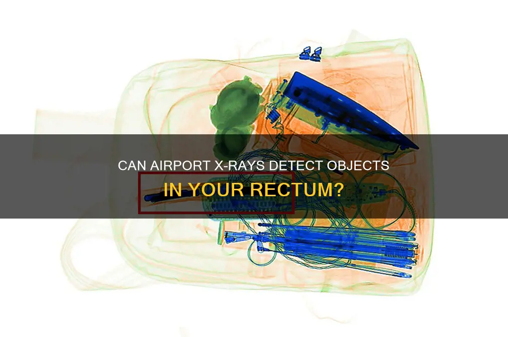 what can airport x ray see something in your rectum