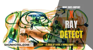 X-Ray Vision: Uncovering Airport Security Secrets