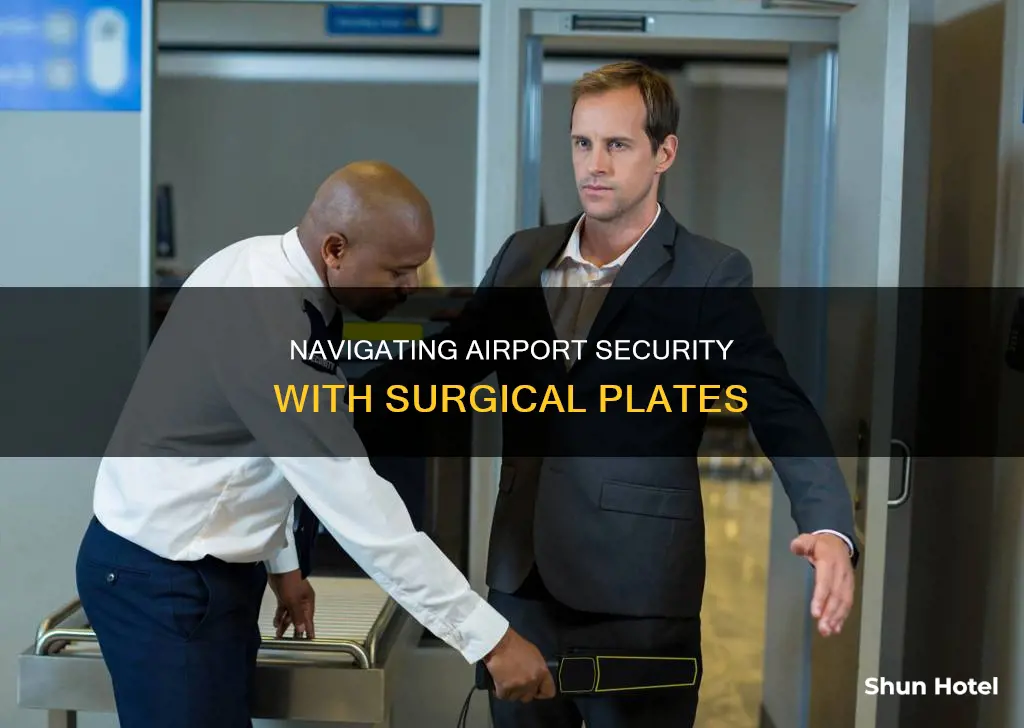 what problems with surgical plate airport