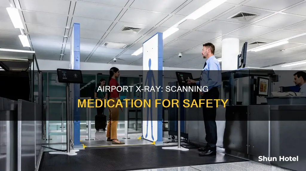 why do airport x ray medication