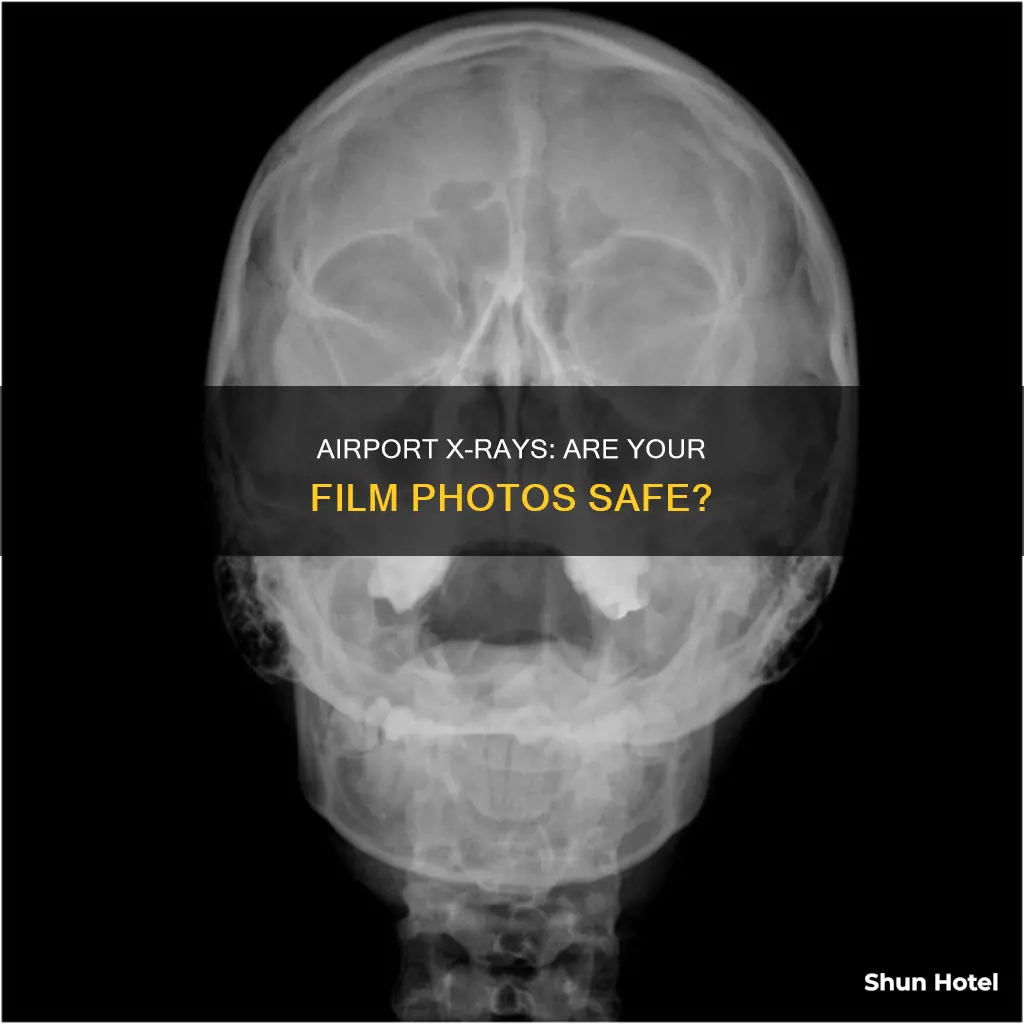 will airport x ray damage film