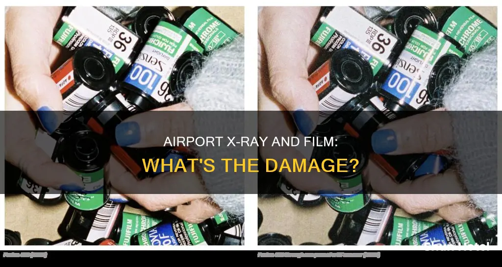 will airport xray ruin my film