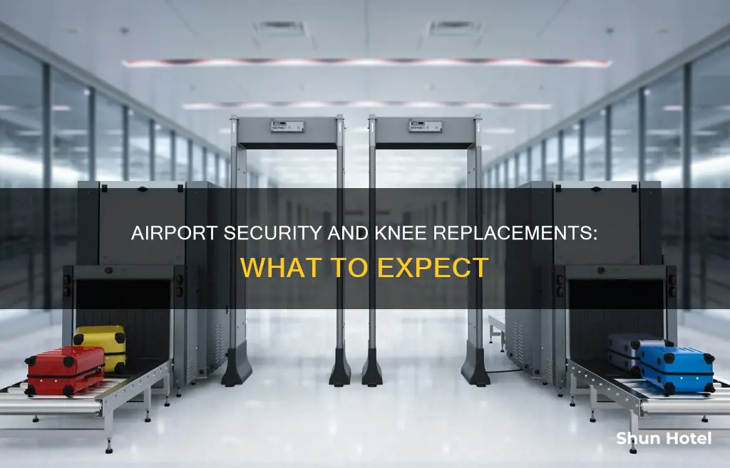 will knee replacement set off airport