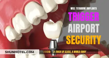 Airport Security and Titanium Implants: What's the Deal?